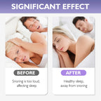 Anti Snoring Devices - Silicone Magnetic(8Nos)