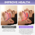 Anti Snoring Devices - Silicone Magnetic(8Nos)