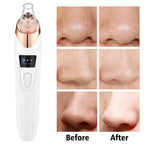 Blackhead Remover